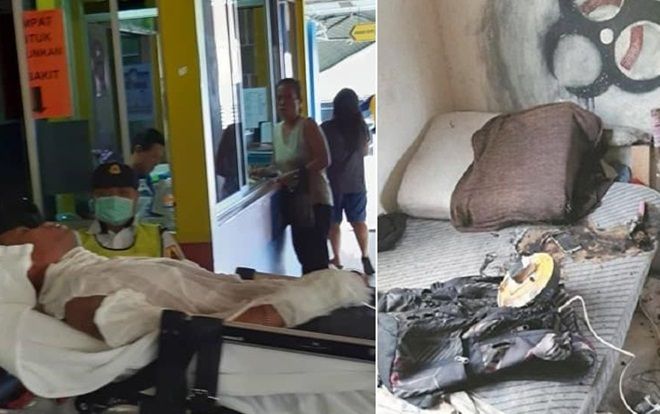 Ngủ gật, thanh niên bị bỏng nặng vì điện thoại đang sạc bất ngờ phát nổ