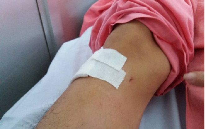 Khoan nhầm cẳng chân bệnh nhân, bệnh viện Chợ Rẫy nói gì?