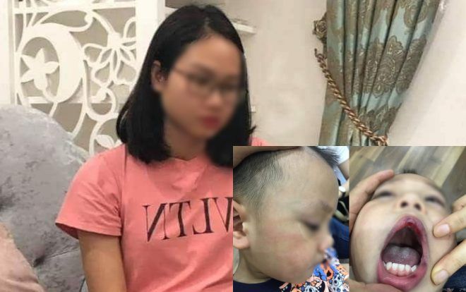 Nữ giáo viên trường mầm non Ecokids đánh học sinh rách môi đang bị hoảng loạn tinh thần và tìm cách tự tử