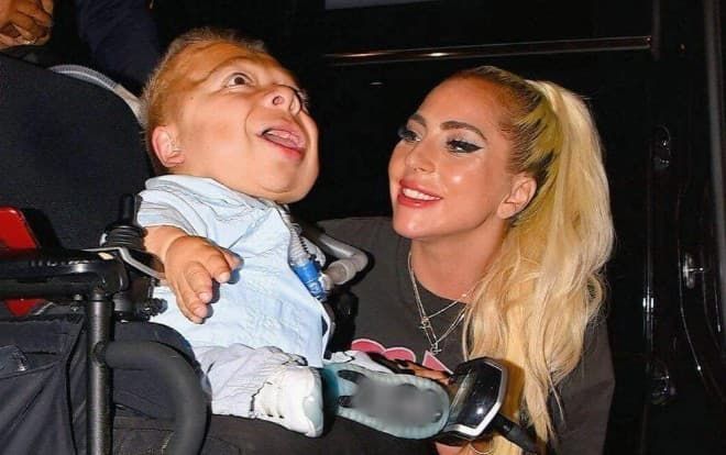 Rớt nước mắt khoảnh khắc Lady Gaga ôm hôn người hâm mộ khuyết tật sau hậu trường đêm diễn