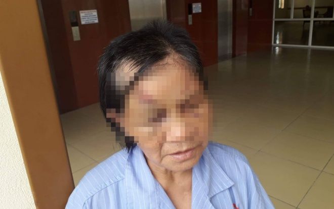 Công an điều tra cháu trai nghi trói chân tay, bịt mồm đánh bà ngoại gãy 5 xương sườn