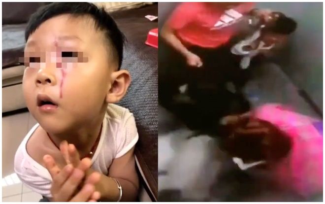 Cậu bé 3 tuổi bị chó Alaska tấn công trong thang máy