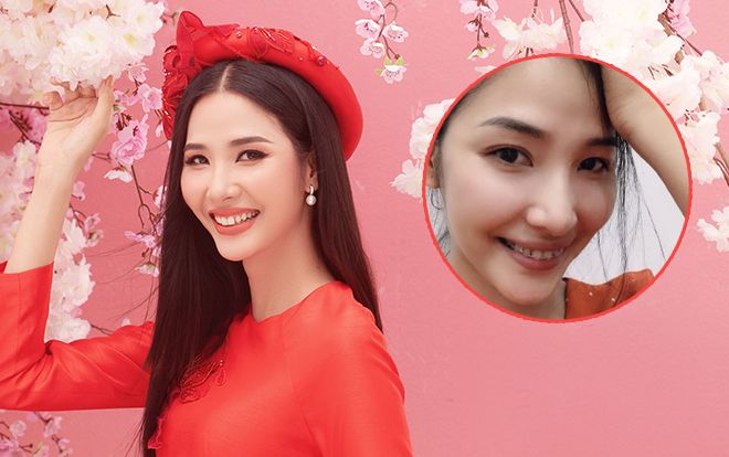 Fan chê cười xấu, Hoàng Thùy niềng răng 'cấp tốc' chuẩn bị chinh chiến Miss Universe 2019