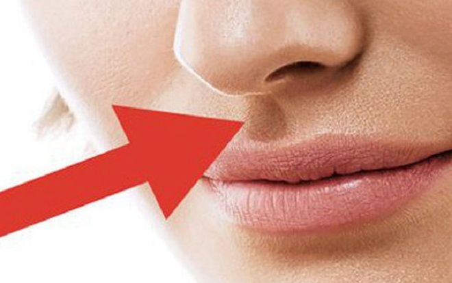 Xem đường nhân trung đoán số giàu sang hay nghèo hèn: Nếu thuộc kiểu số 3, xin chúc mừng!