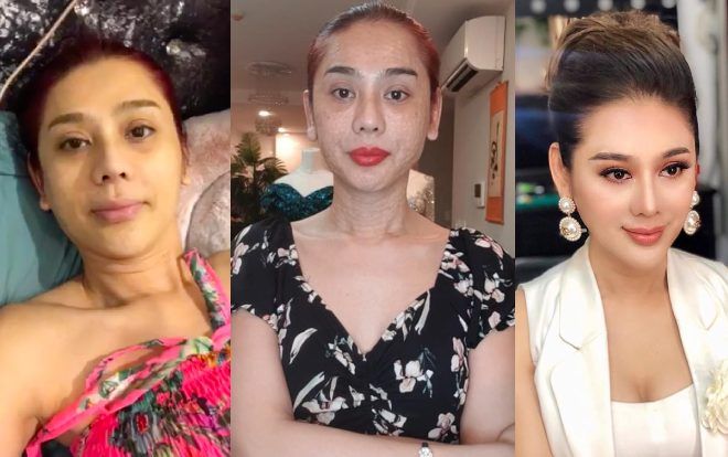 Lâm Khánh Chi: Nhan sắc xuống cấp đáng báo động sau 7 năm phẫu thuật chuyển giới