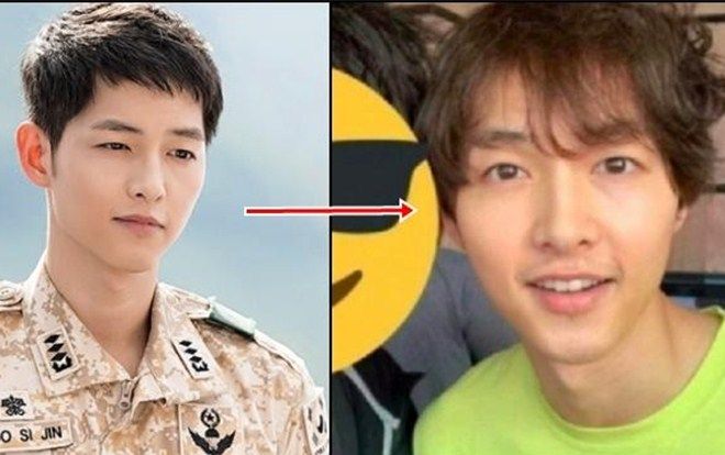 Fan lo lắng Song Joong Ki bị hói đầu vì căng thẳng hôn nhân với Song Hye Kyo