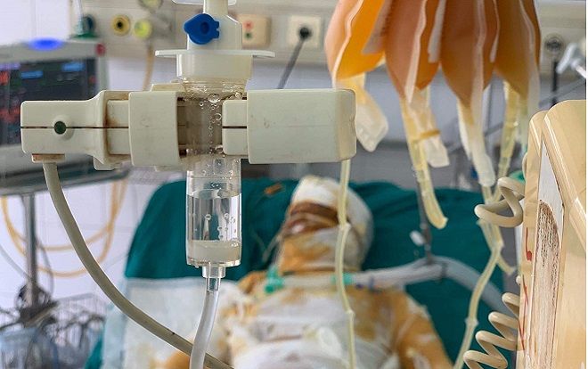 Nỗi đau tận cùng gia đình thiếu phụ cùng con gái 2 tuổi bị người tình tẩm xăng thiêu tử vong, 2 nạn nhân đang cấp cứu trong tình trạng nguy kịch