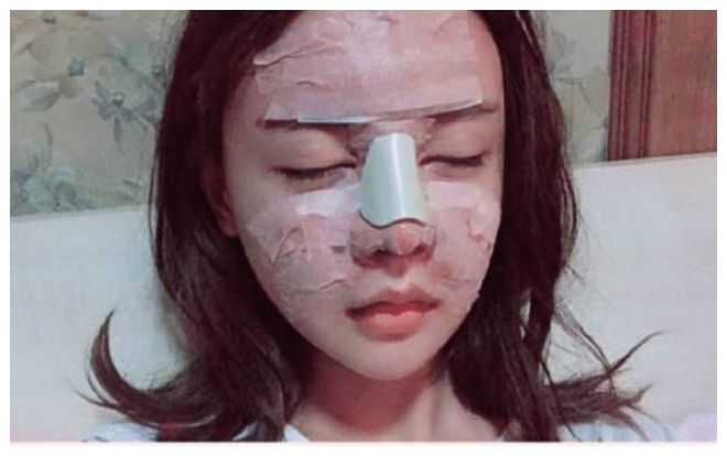 Hot girl Trung Quốc mới 20 tuổi đã dao kéo trên mặt hết 33 lần, nhan sắc hiện tại khiến ai nhìn cũng hoảng