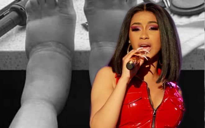 Người hâm mộ lo lắng khi Cardi B cho biết đôi chân của cô đang phải chịu di chứng nặng nề từ việc phẫu thuật thẩm mỹ