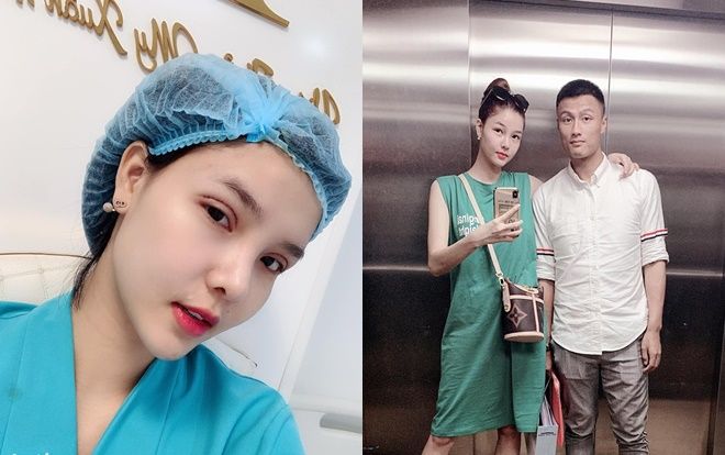 Giữa tin đồn mang bầu lần 2, Kỳ Hân vẫn liều lĩnh phẫu thuật thẩm mỹ?