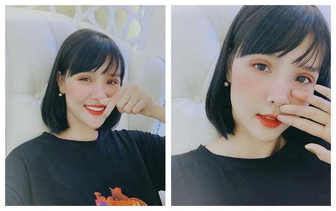 Kỳ Hân khoe ảnh mặt còn sưng húp sau phẫu thuật thẩm mỹ
