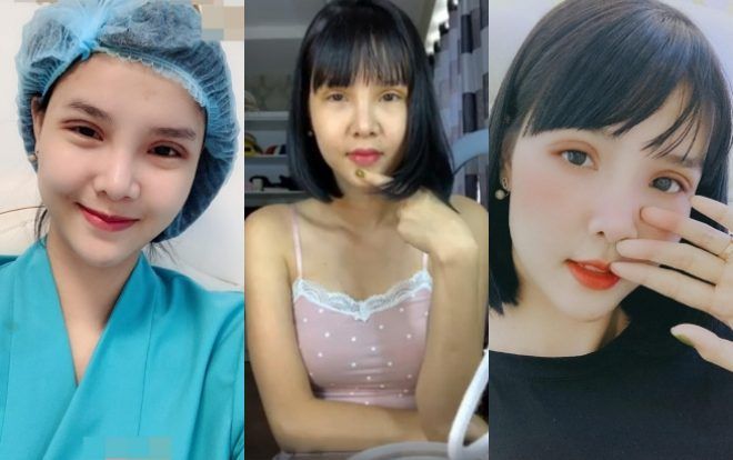 Chi tiền chỉnh sửa nhan sắc, Kỳ Hân vẫn bị chê 'đơ như tượng sáp'