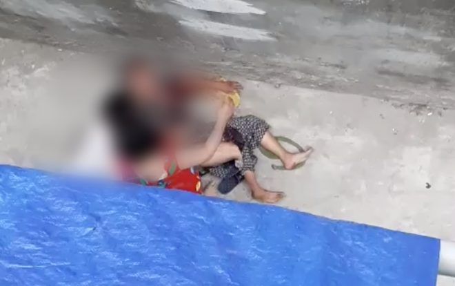 Đi thăm gia đình cháu ngoại, bà lão 76 tuổi bị chó nhà lao vào cắn xé