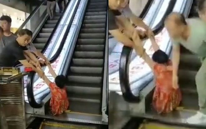 Bị 'nuốt' vào thang cuốn, người phụ nữ phải cắt cụt chân trái