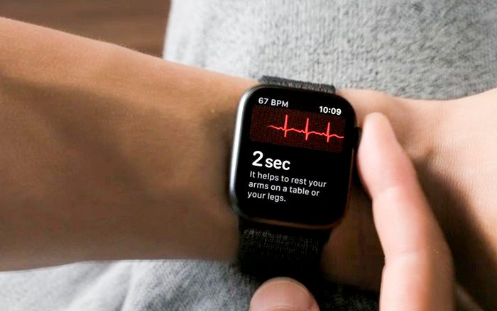 Bác sĩ người Anh cho rằng quá tin vào điện tâm đồ trên Apple Watch có thể gây hại nhiều hơn lợi
