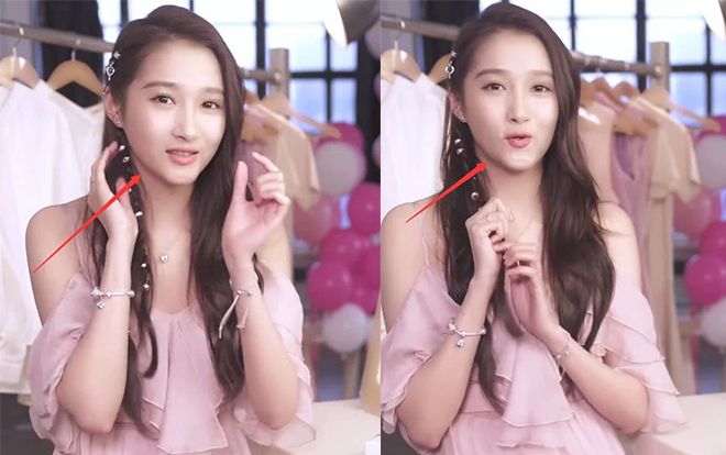 Quan Hiểu Đồng gây chú ý với chiếc cằm 'biến dạng', khác thường - Là di chứng của phẫu thuật thẩm mỹ?