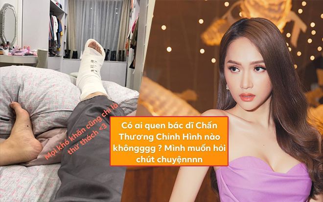 Fan xót xa nhìn Hương Giang bó bột, chấn thương khớp cổ chân, tìm bác sĩ chỉnh hình gấp