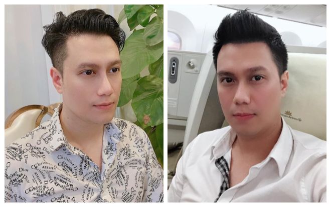 Sau bao tranh cãi cuối cùng Quế Vân cũng liệt kê chi tiết Việt Anh đã thẩm mỹ những gì trên mặt