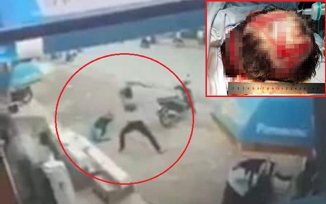 Bảo vệ Điện máy Xanh bị chém trọng thương trước cửa hàng đã qua cơn nguy kịch