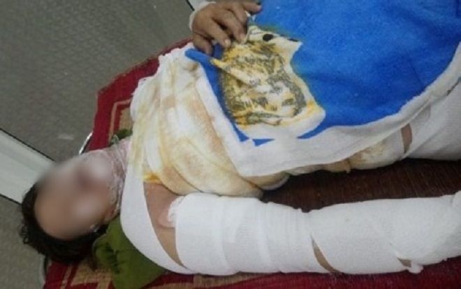 Uống rượu say, chồng 'hờ' tưới xăng rồi châm lửa đốt vợ