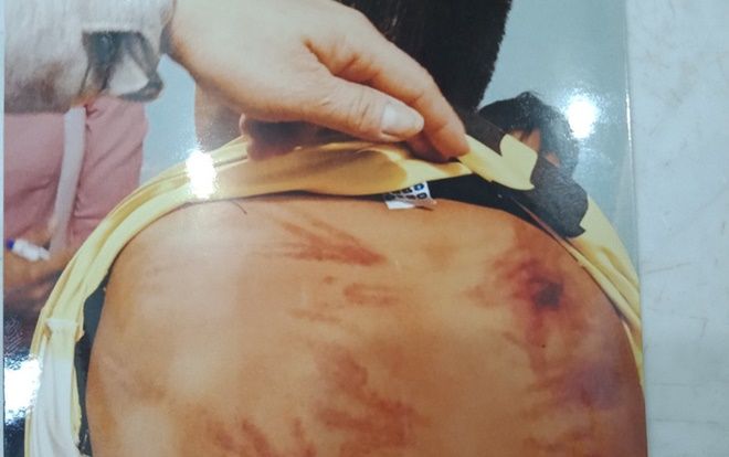 Điều tra vụ bé trai 11 tuổi ở Bình Thuận bị người tu hành đánh dã man