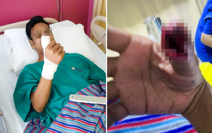 Thanh niên suýt bị cắt cụt tay chỉ vì thói quen mà rất nhiều người hay mắc phải khi dùng smartphone