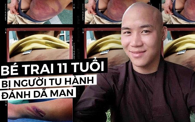 Vụ bé trai 11 tuổi bị người tu hành đánh dã man: Người trong cuộc nói gì?
