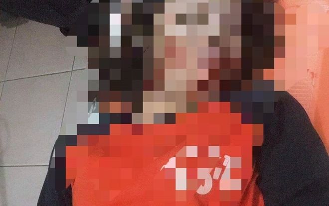 Vướng vào dây điện giữa đường, thiếu nữ 17 tuổi tử vong