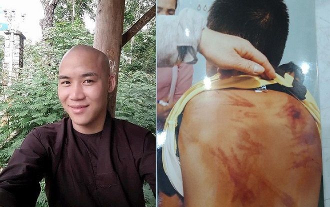 Khởi tố thầy tu bạo hành dã man bé trai 11 tuổi ở Bình Thuận