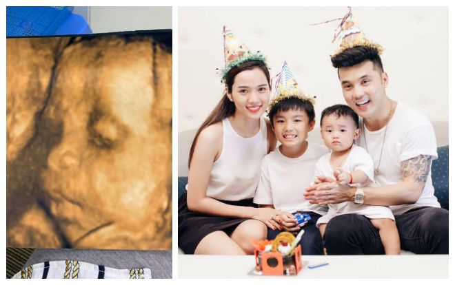 Cận kề ngày sinh, bà xã Ưng Hoàng Phúc khoe ảnh siêu âm và tiết lộ giới tính con yêu