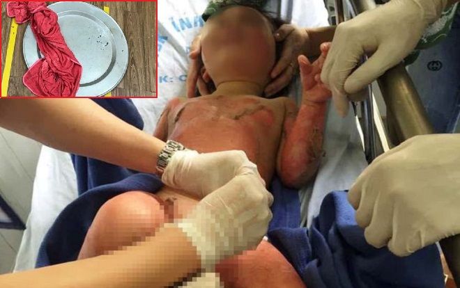 Vụ 3 trẻ mầm non bị bỏng khi học kỹ năng tại trường: Cô giáo không đổ thêm cồn vào lúc lửa đang cháy thì sự việc đáng tiếc không xảy ra