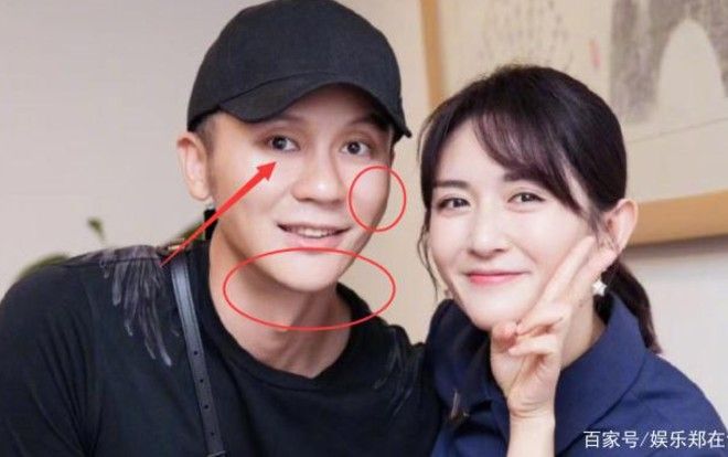 Hậu chia tay với Phạm Băng Băng, Lý Thần xuống sắc trầm trọng