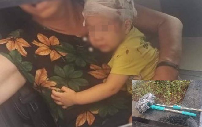 Bé trai 16 tháng tuổi bị chiếc chổi lau nhà rơi từ tầng 17 chung cư trúng toác đầu phải nhập viện