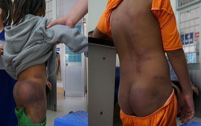 Điều tra nghi vấn 4 học sinh tiểu học bị người thân bạo hành dã man
