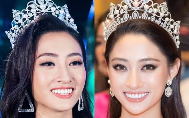 Rộ tin đồn hoa hậu Lương Thùy Linh làm lại răng sau 1 tháng đăng quang Miss World Vietnam