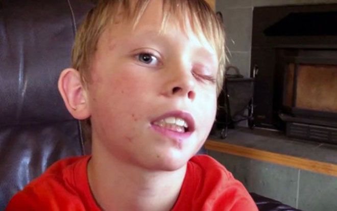 Bị báo sư tử vồ ngay trước cửa nhà, cậu bé 8 tuổi gan dạ chống trả bằng tay không