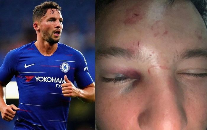 Gạ tình vợ đồng nghiệp, sao Chelsea bị ăn đấm