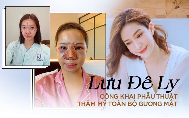 Công khai phẫu thuật thẩm mỹ toàn bộ gương mặt, Lưu Đê Ly khiến ai cũng choáng váng
