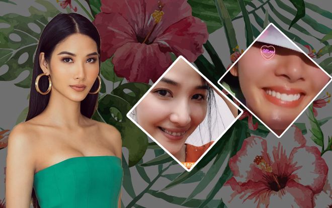 Hoàng Thùy phơi da nâu chuẩn Miss Universe, lần đầu khoe nụ cười sau khi niềng răng cấp tốc