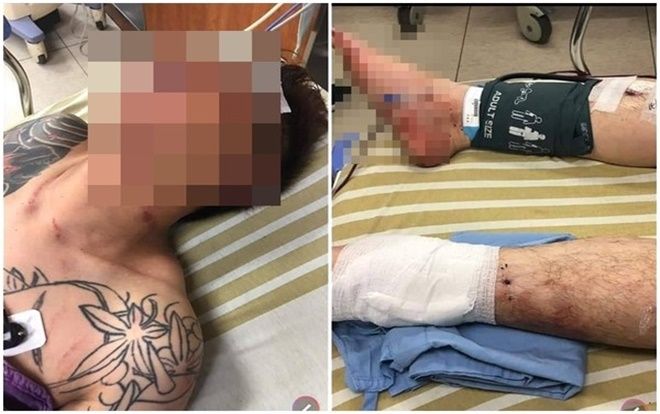 Đang quay trực tiếp, nam phóng viên bị bắt cóc và hành hạ dã man nhưng sự thật phía sau gây sốc hơn