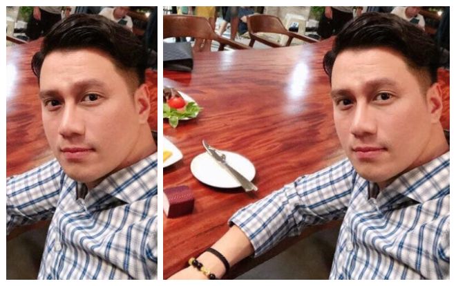 Được khen chưa bao lâu Việt Anh lại gây tò mò với gương mặt kém sắc hậu thẩm mỹ