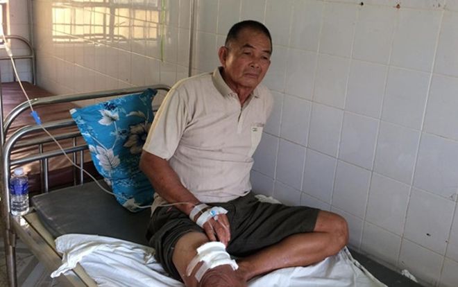 Vụ em ruột nổ súng bắn vợ chồng anh trai ở Bình Phước: Nạn nhân kể nguyên do