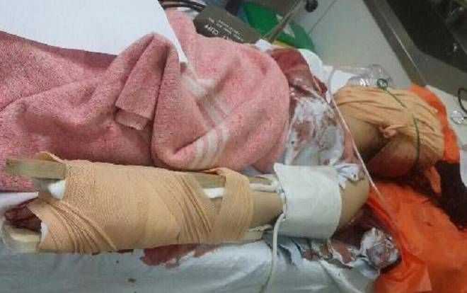 Người đàn ông dùng dao chém vợ 'hờ' nguy kịch sau khi đi nhậu về