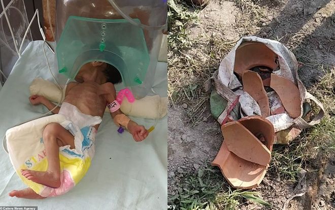 Bị chôn sâu gần 1 mét dưới đất, bé gái sơ sinh gây ngỡ ngàng khi còn sống