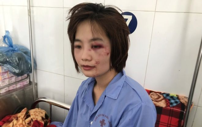 Nữ phụ xe buýt bị nhóm thanh niên xăm trổ hành hung: 'Tôi cảm thấy bị tổn thương, đánh tôi xong họ vứt lại 1 triệu bảo cầm mà mua thuốc'