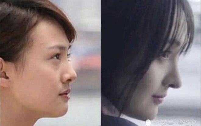 Dấn thân vào thời trang, Trịnh Sảng bị tố để lộ di chứng phẫu thuật thẩm mỹ