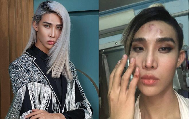 Sau diễn viên Kim Nhã, lại thêm người mẫu The Face Mid Nguyễn tố bị tài xế Go Viet hành hung