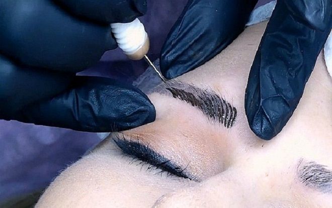 Người phụ nữ 65 tuổi biến chứng nặng sau khi xăm chân mày thẩm mỹ đã tử vong