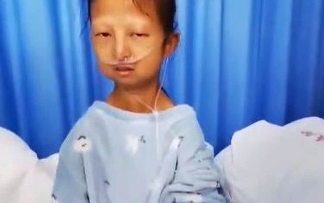 Cô gái 24 tuổi suy kiệt cơ thể sau 5 năm chỉ ăn cơm và ớt cùng câu chuyện cảm động phía sau