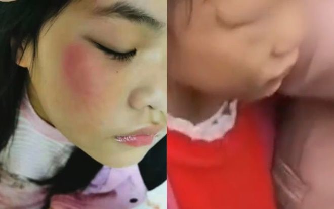 Giáo viên dạy thay đánh học sinh tiểu học dã man chỉ vì… viết sai một chữ